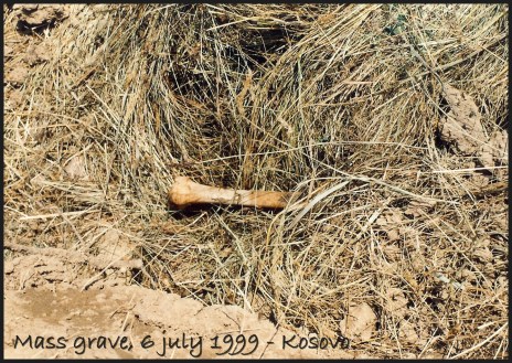 Kosovo mass grave bone (2)